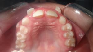 A16 pl1wer - Eugenol