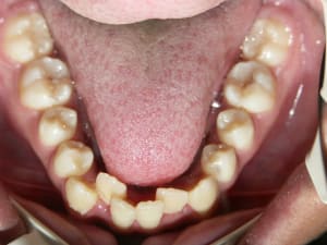 A6 g5dbbc - Eugenol