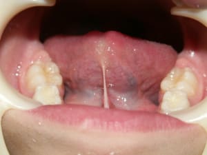A9 d8lars - Eugenol
