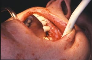 Alexis serge 10 ftsjod - Eugenol