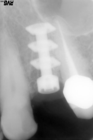 Alexis serge 11 ukrxce - Eugenol