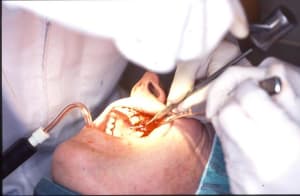 Alexis serge 7 yyicsw - Eugenol