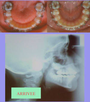 Arrivee  i12fof - Eugenol