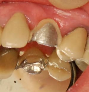 Armature taiil e cvnwbl - Eugenol