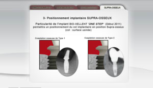 Bio xellent one step anbfgt - Eugenol