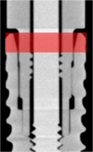 Bone level n9bbo6 - Eugenol