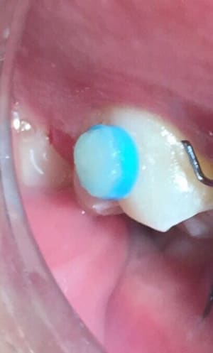 Ca34e860 cfb6 4603 8c2c a43d60b235c8 rysj6l - Eugenol