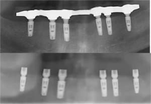 Ckoi xxjw7v - Eugenol
