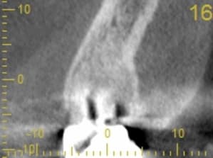 Cs 20131209 0838 16 pbdisu - Eugenol