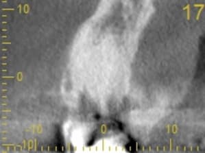 Cs 20131209 0838 17 mhlamm - Eugenol