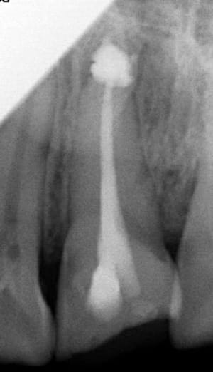 Capture01 p22zsz - Eugenol