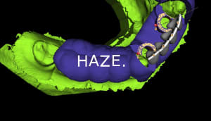 Capture11 zr7ibg - Eugenol