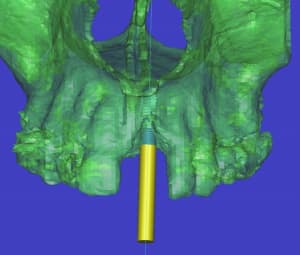 Capture4 lbzd7r - Eugenol