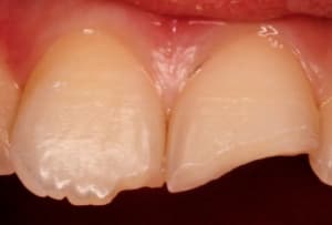 Capture d écran 2017 01 25 à 23.27 - Eugenol