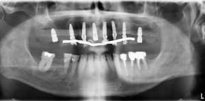 Capture d écran 2017 04 11 à 19.46 - Eugenol