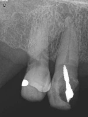 Capture d e cran 2016 04 11 16.52 - Eugenol