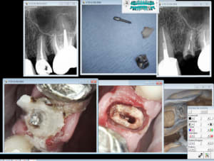 Capture d e cran 2016 04 12 00.47 - Eugenol