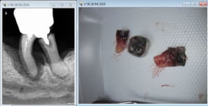 Capture d e cran 2016 04 26 17.24 - Eugenol