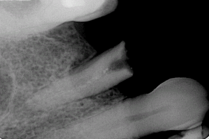 Capture o4g5qo - Eugenol