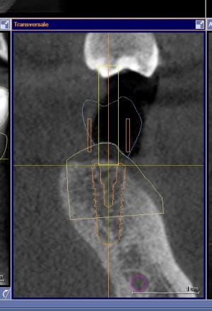 Capture xgjg7h - Eugenol