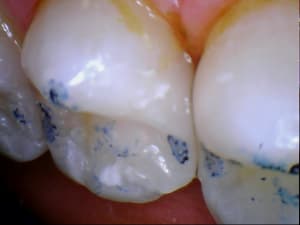 Caval 20120214 16 19 - Eugenol
