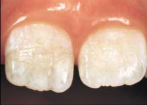 Cliché 2006 05 04 15 39 18 tg4zjz - Eugenol
