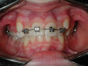 Copie dedscn3170 kwkbyn - Eugenol