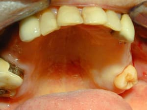 Début qusqmg - Eugenol