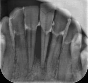 D644118a d046 4d49 a644 0c985bbe933a otyspi - Eugenol