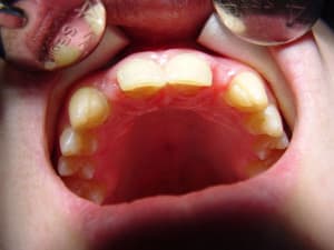 Dsc00087 fgms53 - Eugenol