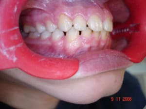 Dsc00925 j7xpqj - Eugenol