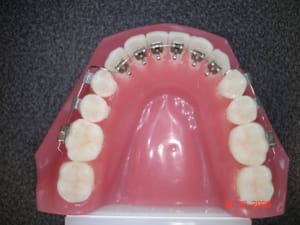 Dsc01000 aiatrz - Eugenol