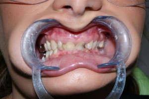 Dsc03298  1  q6p6nh - Eugenol