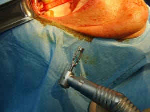 Dsc04605 xpbexh - Eugenol