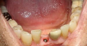 Dsc05191 x8dtdm - Eugenol