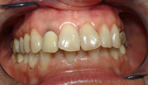 Dsc06108 kjhwu2 - Eugenol