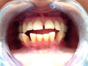 Dscf0538 z1lyl8 - Eugenol