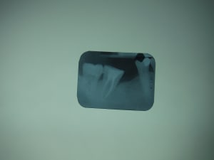 Dscf2355 rtgzk6 - Eugenol