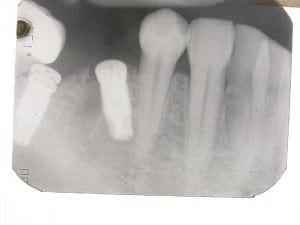 Dscn0381 copie wrm9zh - Eugenol