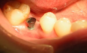 Dscn0514 gswgrp - Eugenol