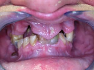 Dscn0788 dlq2wp - Eugenol