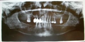 Dscn1903 hzvkub - Eugenol