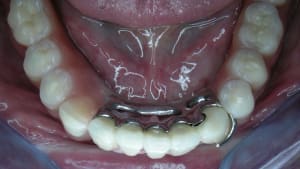 Dscn1999 sxmzdb - Eugenol