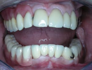 Dscn2000 aw1q5j - Eugenol