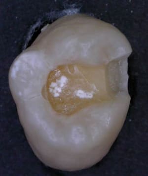 Dscn2474w5 lxlkcp - Eugenol