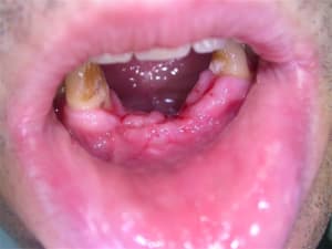 Dscn2696 emsavg - Eugenol