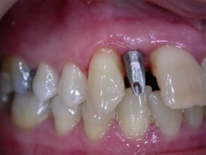 Dscn3219 ivtuie - Eugenol