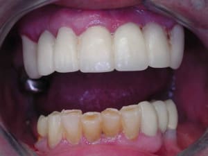 Dscn3375 wtjkhj - Eugenol