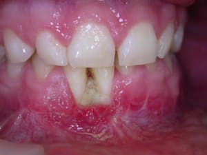 Dscn3405a cjuhqo - Eugenol