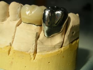 Dscn3745 opdkfs - Eugenol